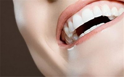 牙齿美白可以去除牙色素吗？