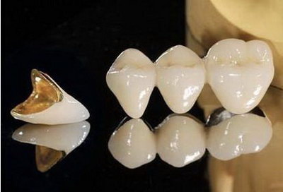 牙齿可以种植生长吗(牙齿掉了两年还可以即刻种植吗)