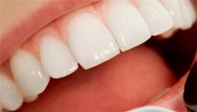 牙龈红发痒是怎么回事(牙龈红发痒，是什么原因引起的？)