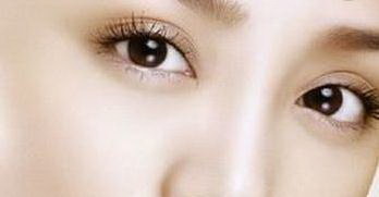中式双眼皮是什么