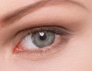 冬季割双眼皮恢复多久(什么是双眼皮手术？)