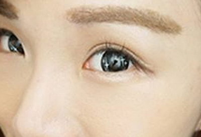 中式双眼皮是什么